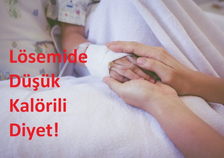 Lösemide Düşük Kalorili Diyet ve Egzersiz Kemoterapi Cevabini Artırıyor