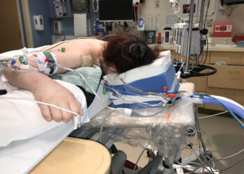 KOVİD’de Ağır Hastalık Yapan ve Öldüren Proteinler