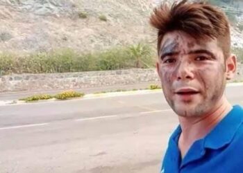 Kendi Kendine Konuşana Ne Denir